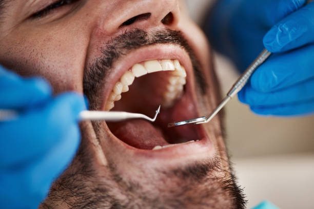 Best Emergency Pediatric Dental Care in East End, AR